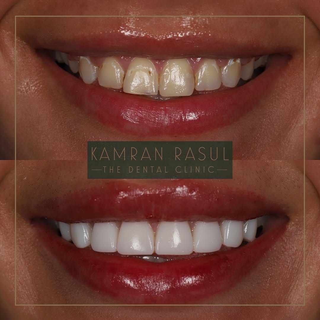 Post 5 by Kamran Rasul on Instagram (carousel)