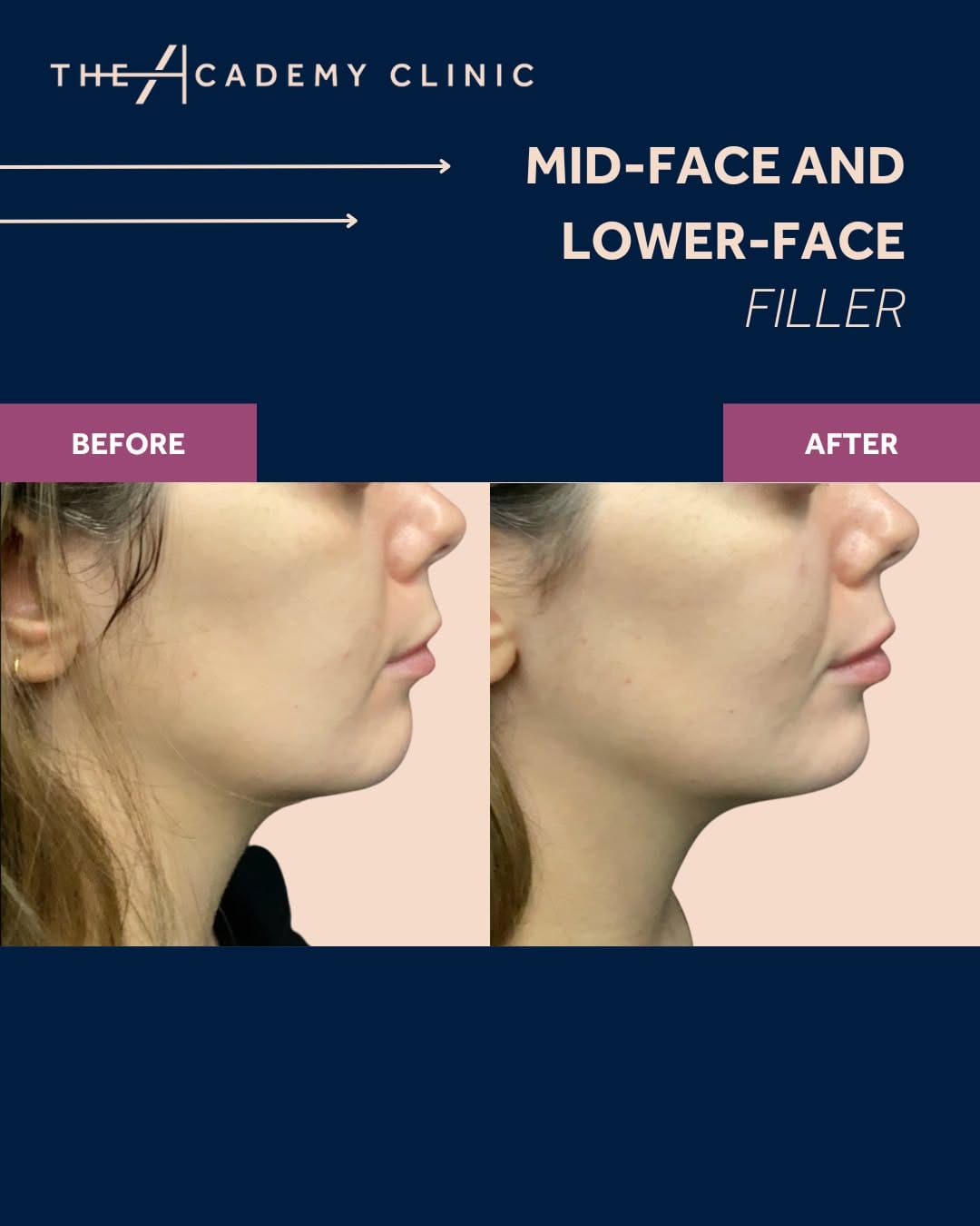 Post 2 by The Academy Clinic on Instagram (image)