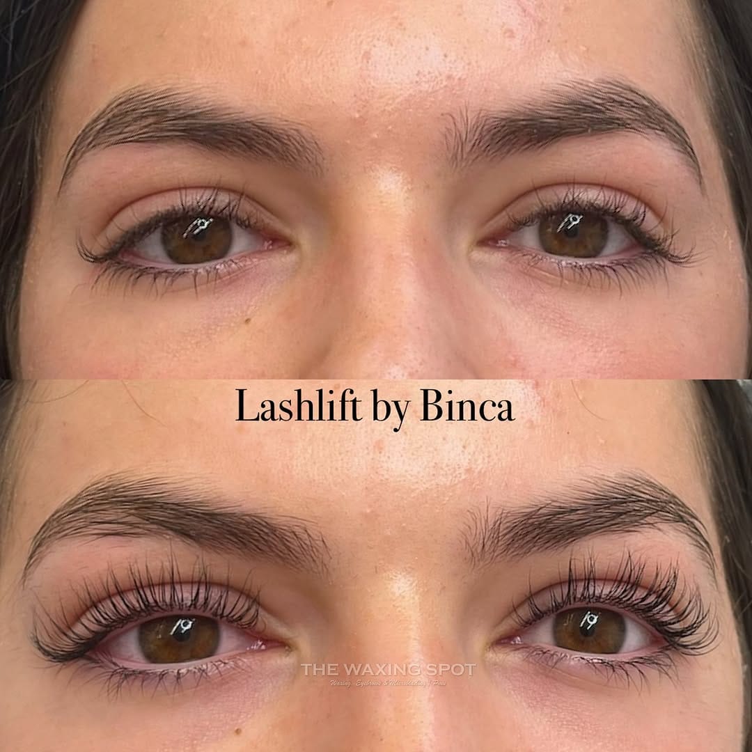 Post 6 by Nanobrows, Waxing & Browbar on Instagram (image)