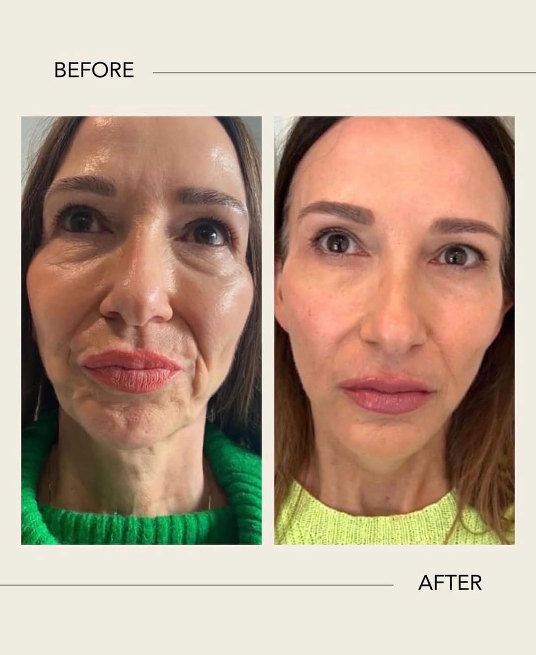 Post 7 by Dr Nyla Raja on Instagram (image)