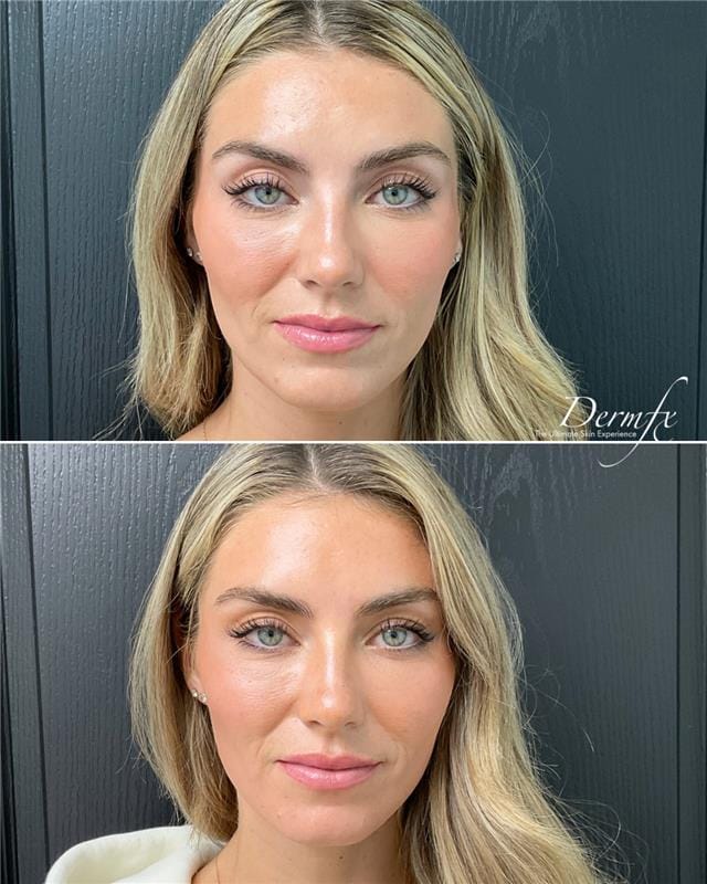 Post 4 by DermFx on Instagram (image)