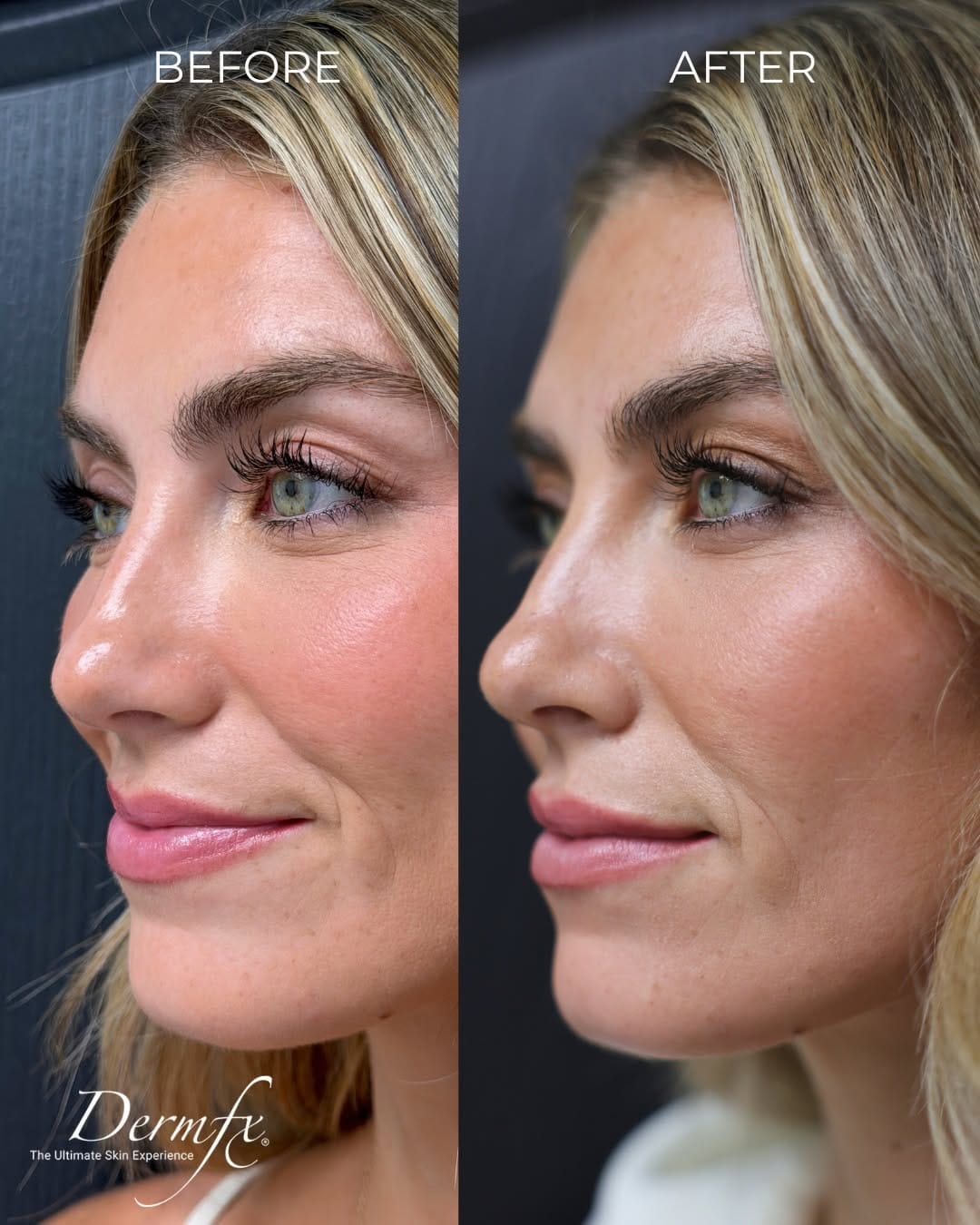 Post 8 by DermFx on Instagram (image)