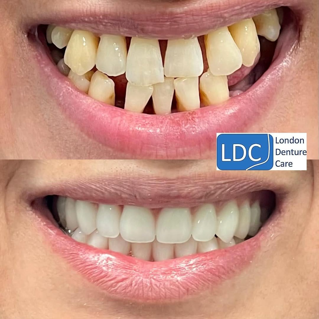 Post 2 by London Denture Care on Instagram (image)