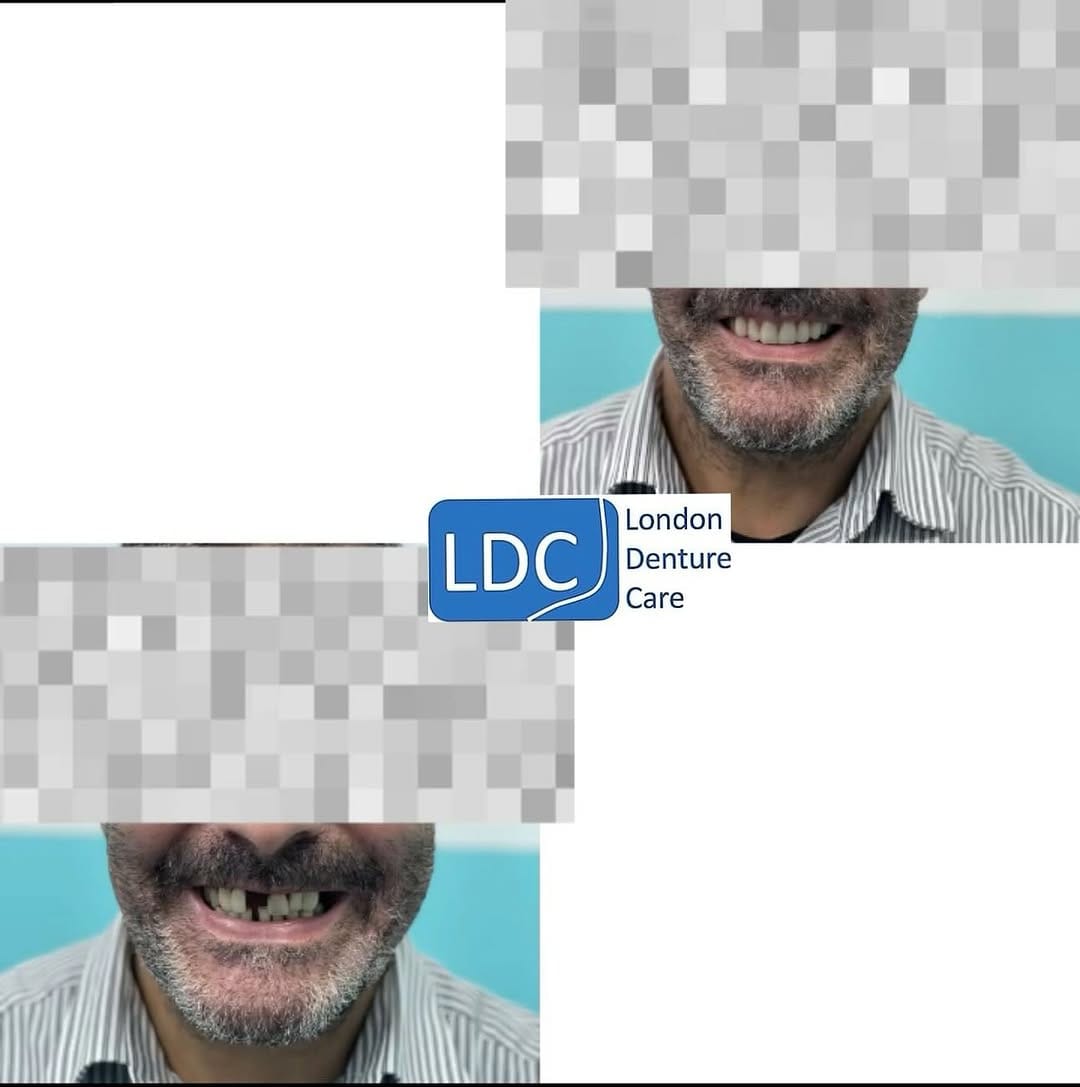 Post 9 by London Denture Care on Instagram (image)
