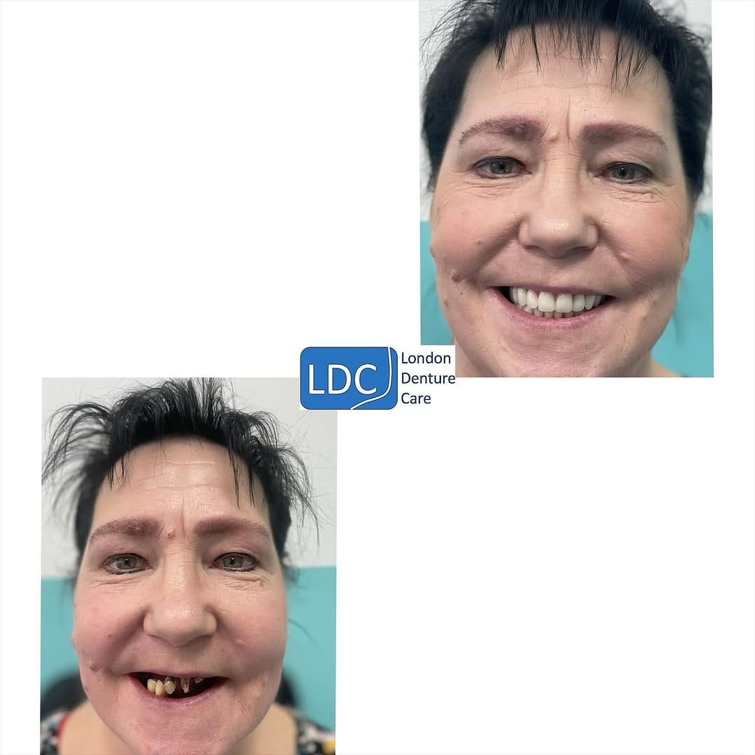Post 8 by London Denture Care on Instagram (image)