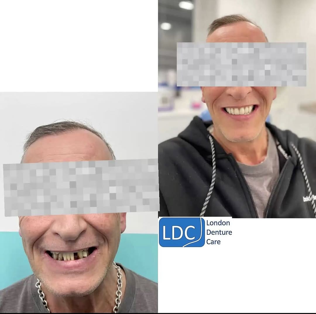 Post 10 by London Denture Care on Instagram (image)