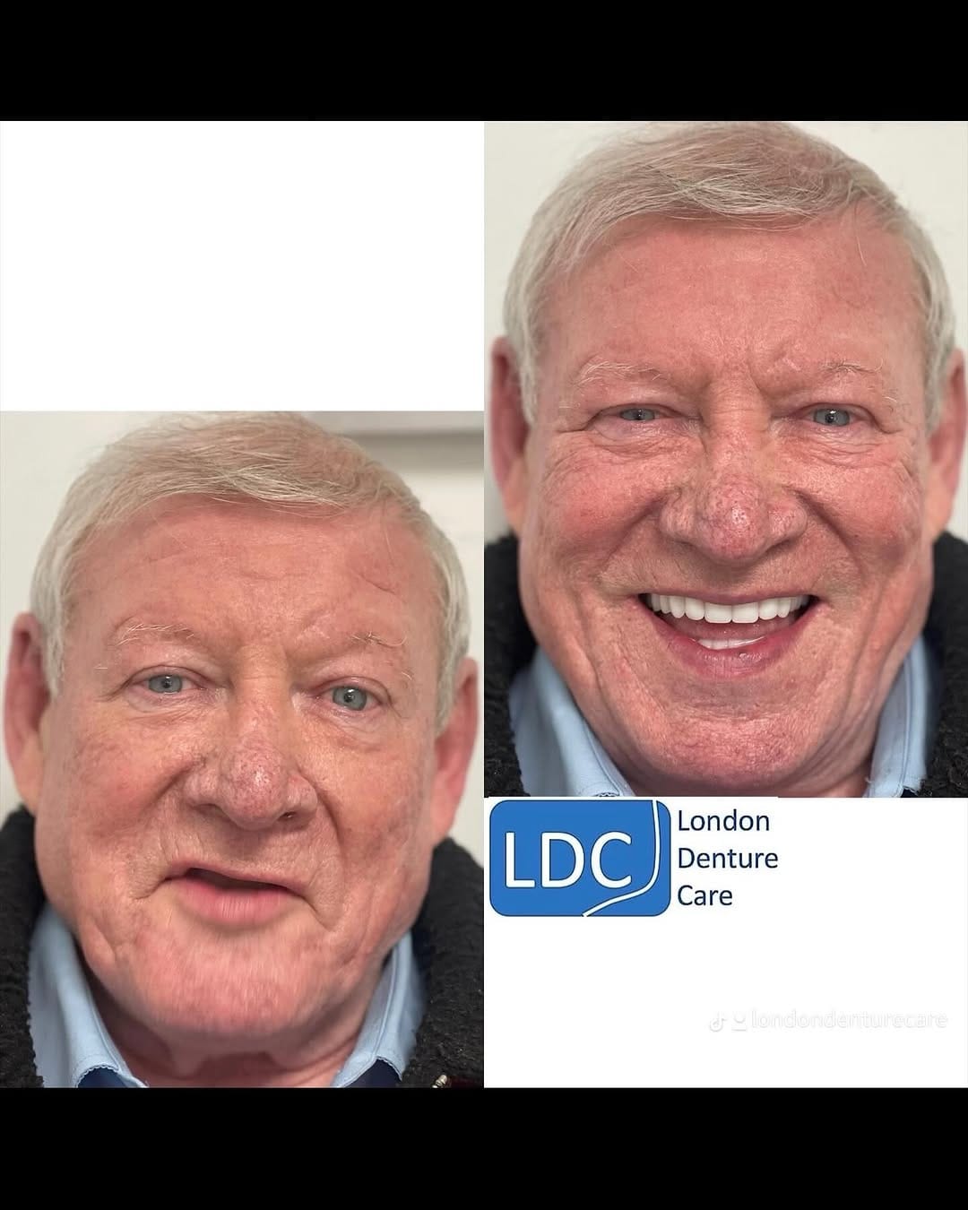 Post 7 by London Denture Care on Instagram (image)