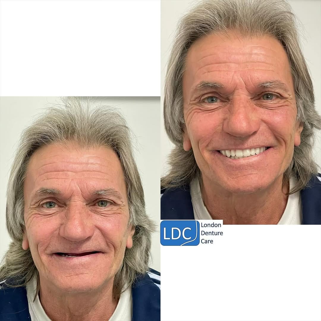 Post 4 by London Denture Care on Instagram (image)