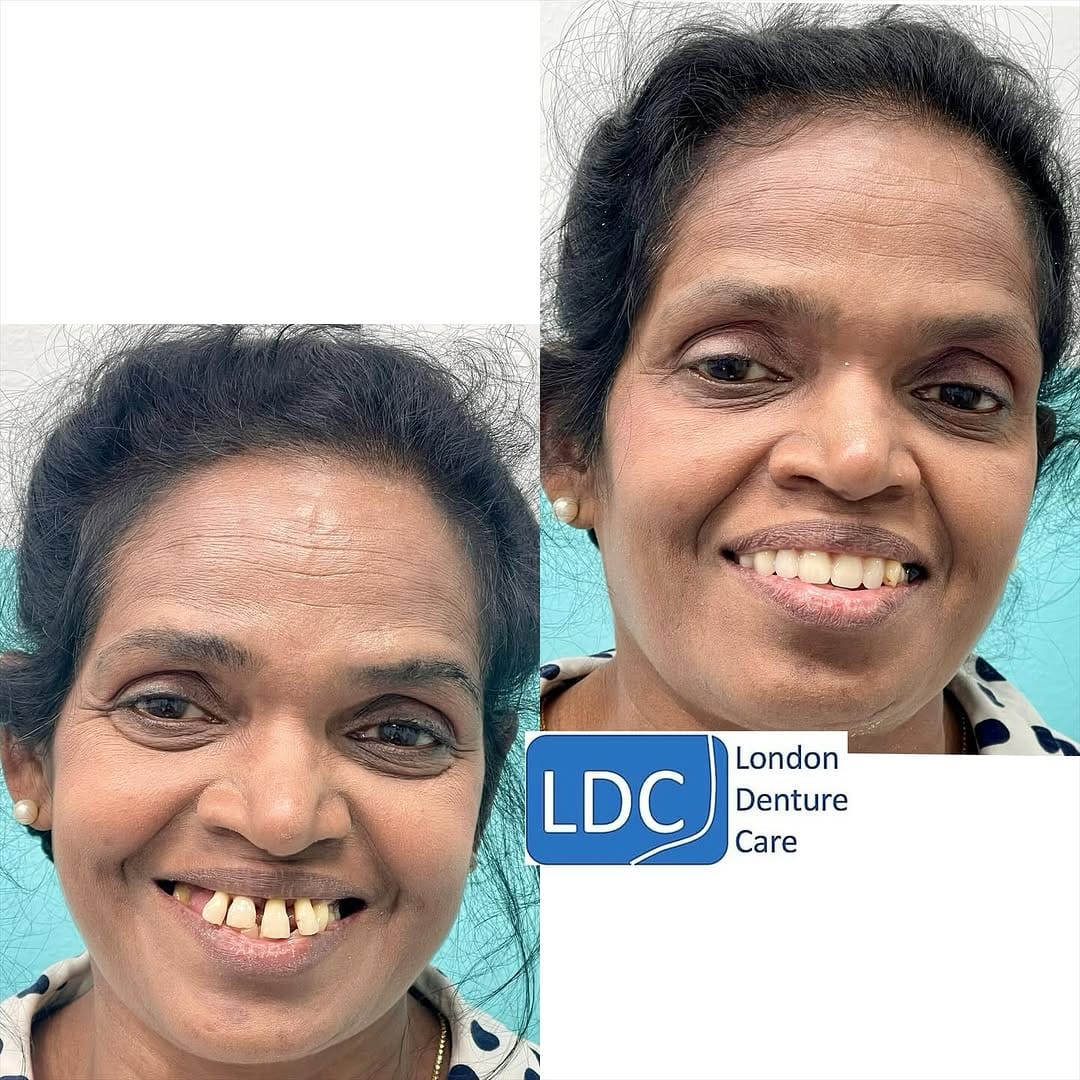 Post 3 by London Denture Care on Instagram (image)