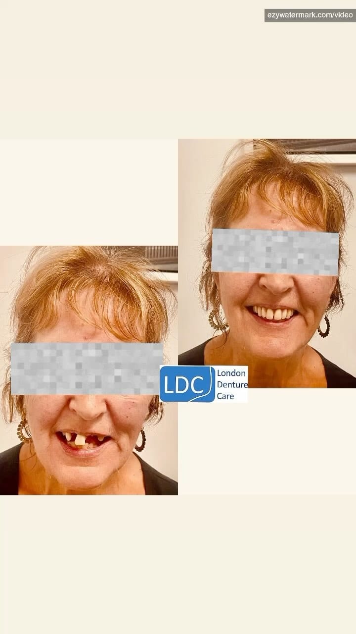 Post 5 by London Denture Care on Instagram (video)