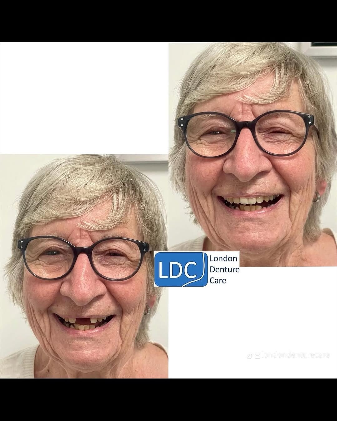 Post 6 by London Denture Care on Instagram (image)