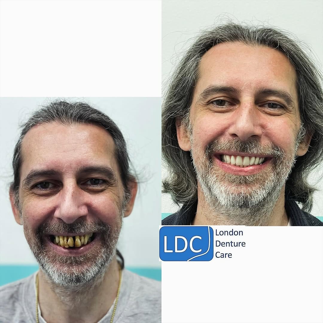 Post 1 by London Denture Care on Instagram (image)