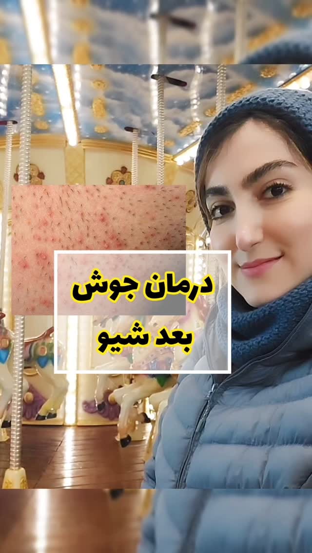 Post 5 by Dr.Abdi | SkinCare | Product Reviewer on Instagram (video)