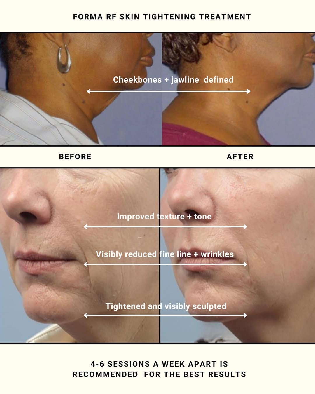 Post 8 by Facial Lounge Newport Beach and Costa Mesa on Instagram (carousel)