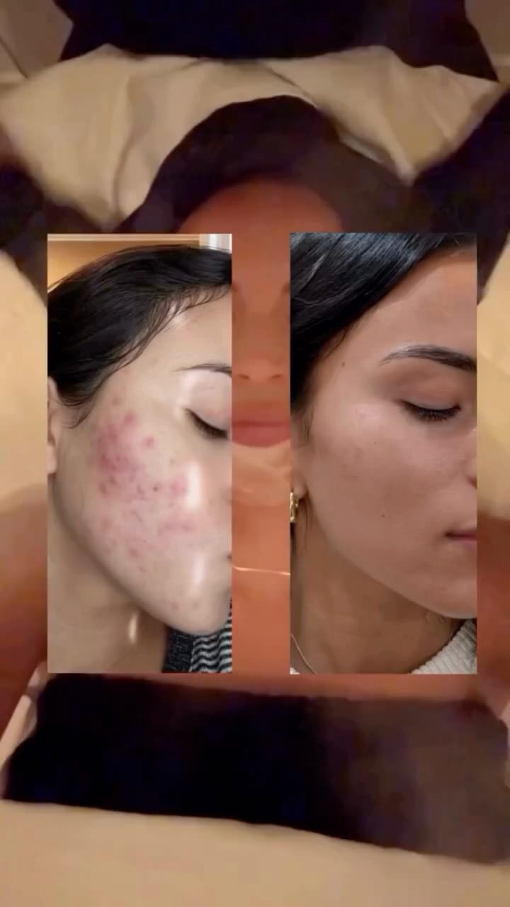 Post 4 by Facial Lounge Newport Beach and Costa Mesa on Instagram (video)