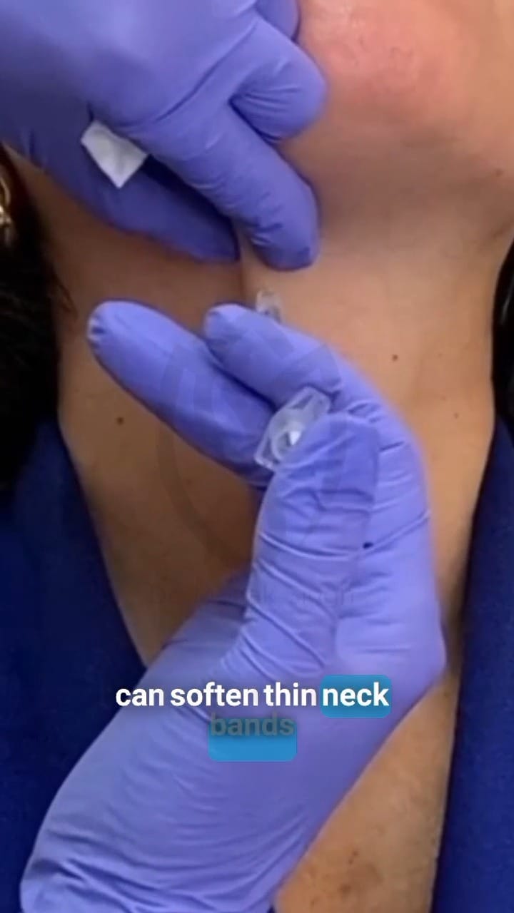 Post 9 by Mehak Singh MD| Dermatologist| Mohs & Dermatosurgeon on Instagram (video)