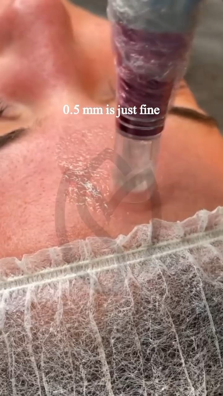 Post 10 by Mehak Singh MD| Dermatologist| Mohs & Dermatosurgeon on Instagram (video)