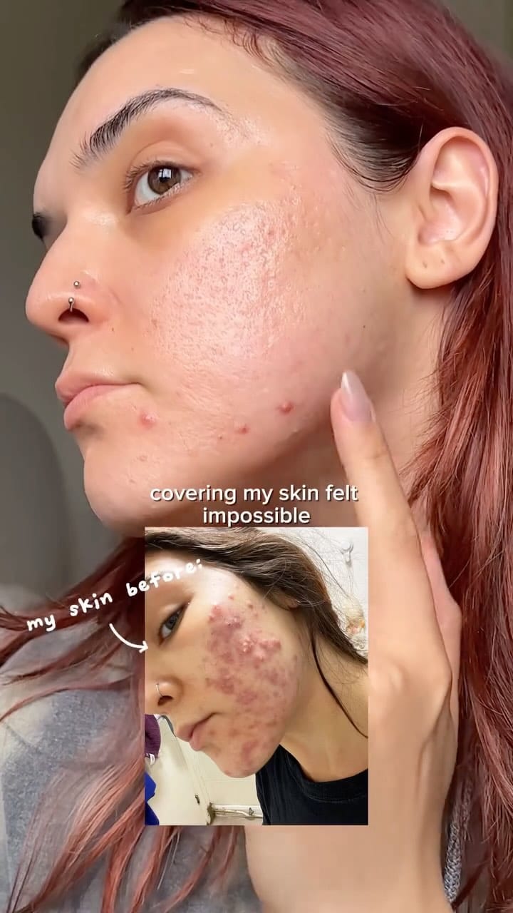 Post 6 by Patsy on Instagram (video)