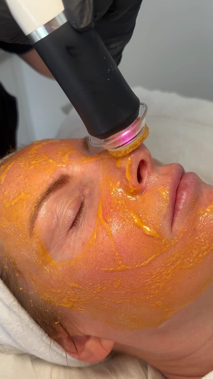 Post 6 by Renew Skin Clinic | Skincare Experts on Instagram (video)