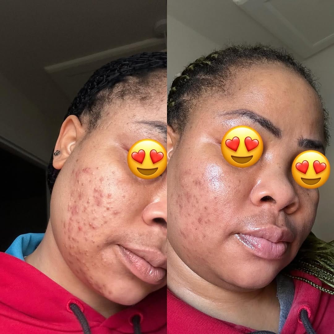 Post 10 by Imma Ojeh | Skincare Educator on Instagram (carousel)
