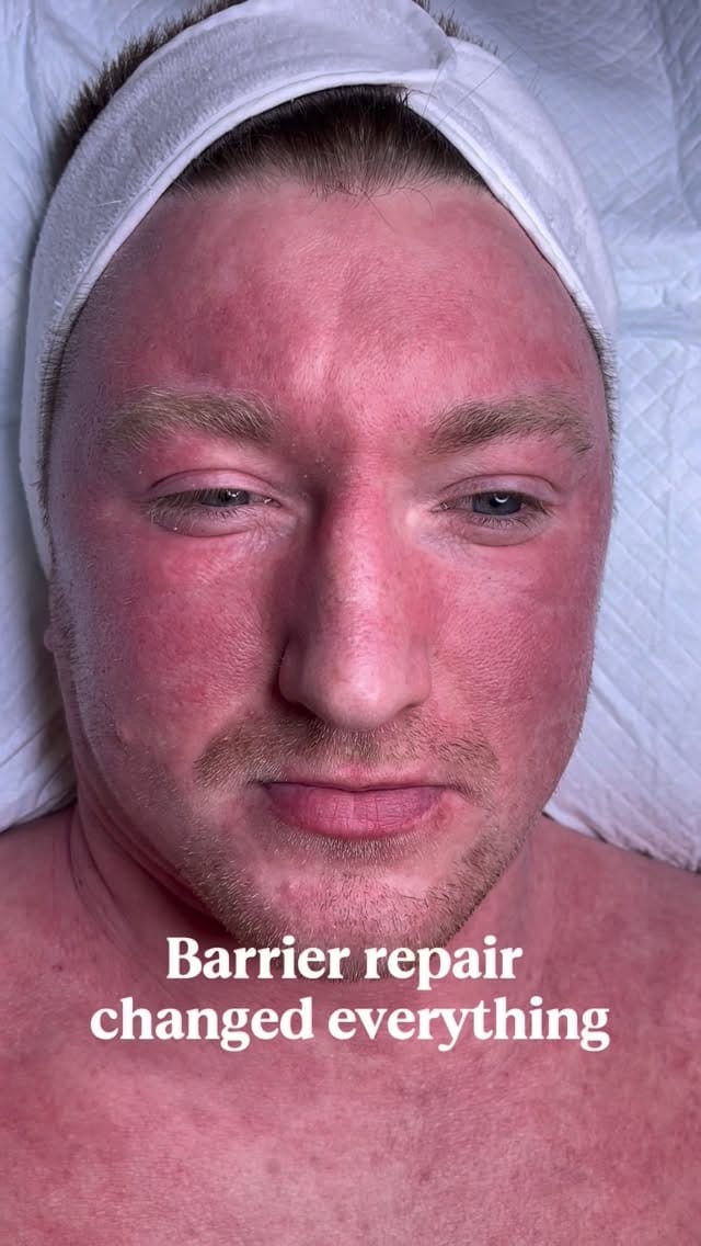 Post 3 by Skin Clinic | Ageing & Acne Specialist N. Ireland on Instagram (video)