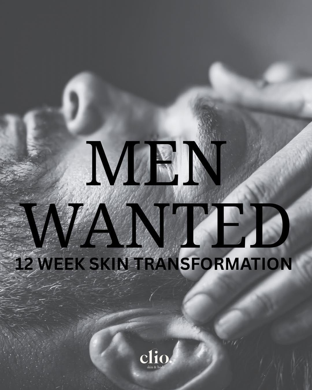 Post 6 by Skin Clinic | Ageing & Acne Specialist N. Ireland on Instagram (image)
