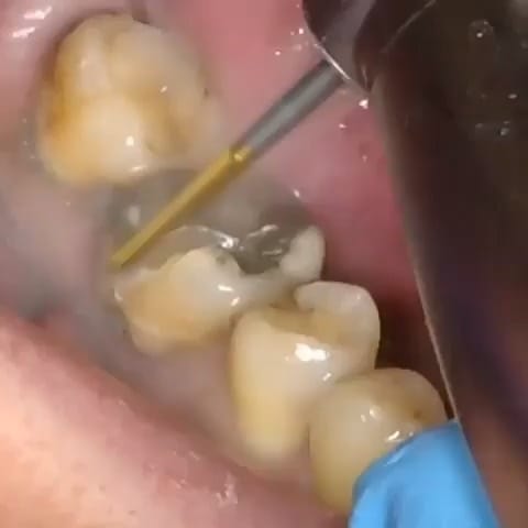 Post 8 by Pouyan Davoudi on Instagram (video)