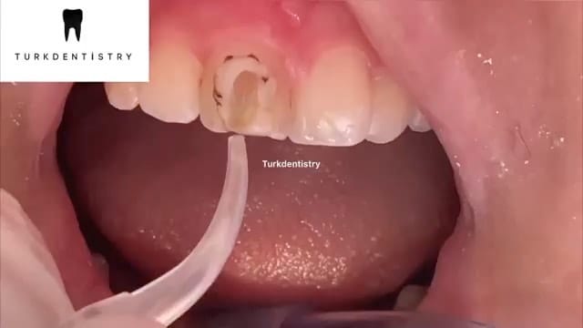 Post 7 by Pouyan Davoudi on Instagram (video)