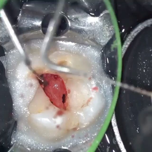 Post 4 by Pouyan Davoudi on Instagram (video)