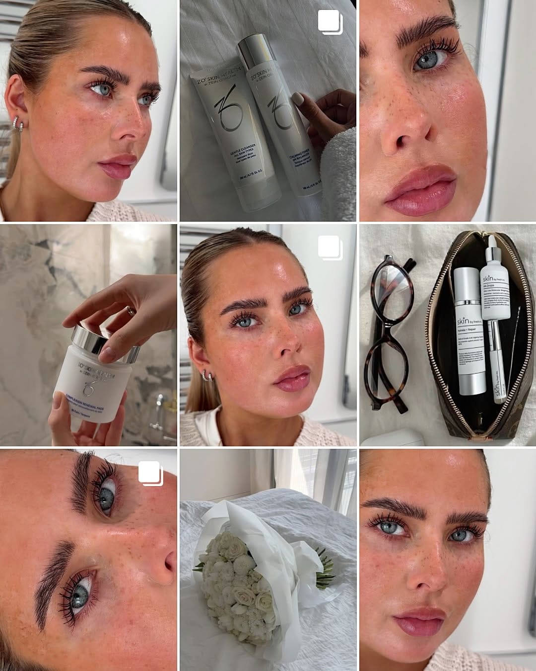 Post 2 by Skincare & Aesthetics Clinic on Instagram (carousel)