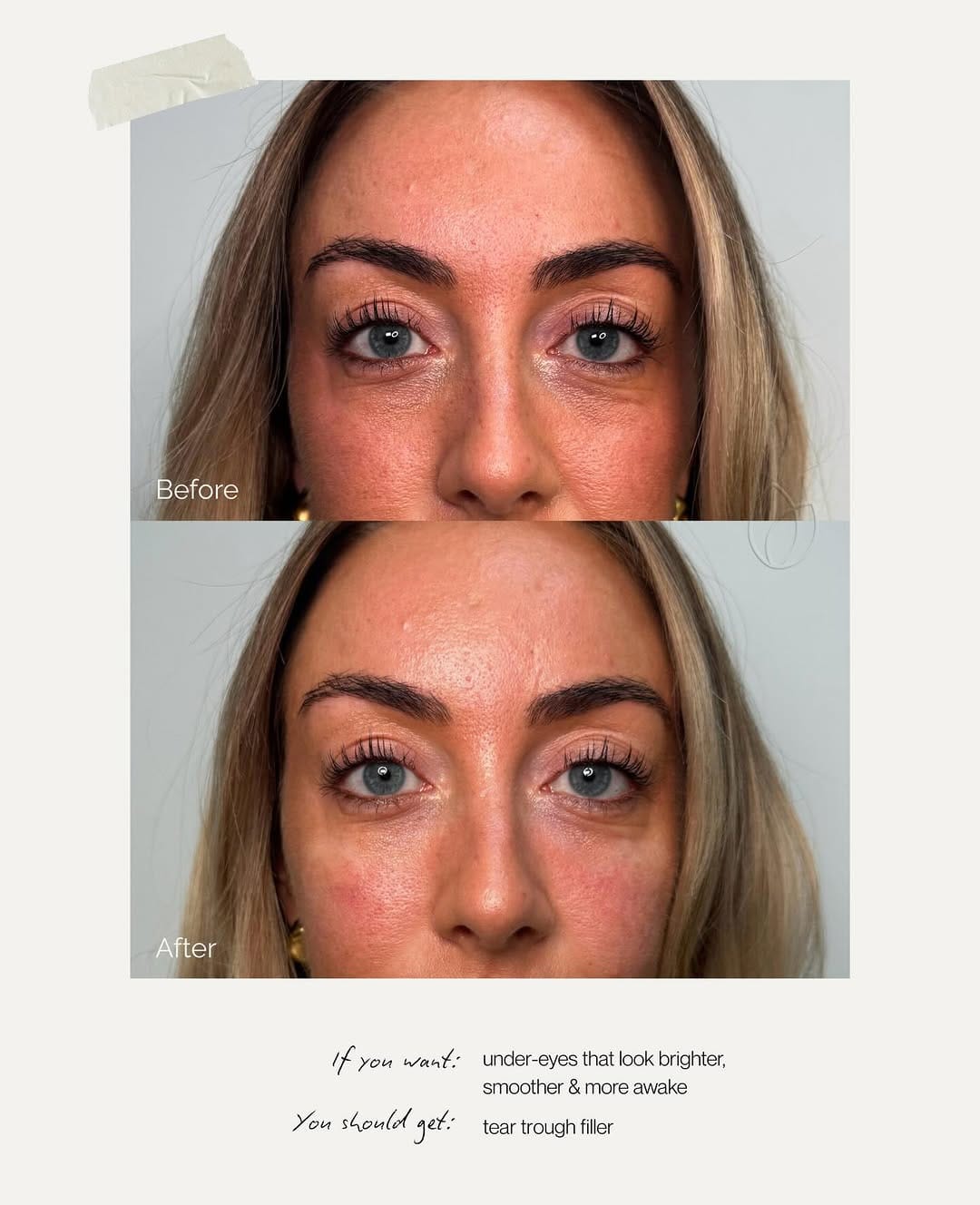 Post 3 by Skincare & Aesthetics Clinic on Instagram (image)