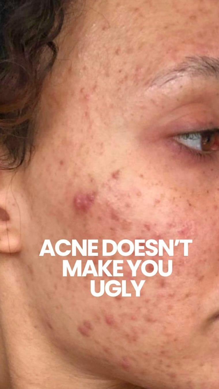 Post 10 by Deanna | Skincare, Curls & Wellness on Instagram (video)