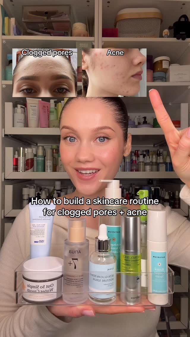 Post 5 by iona francis on Instagram (video)
