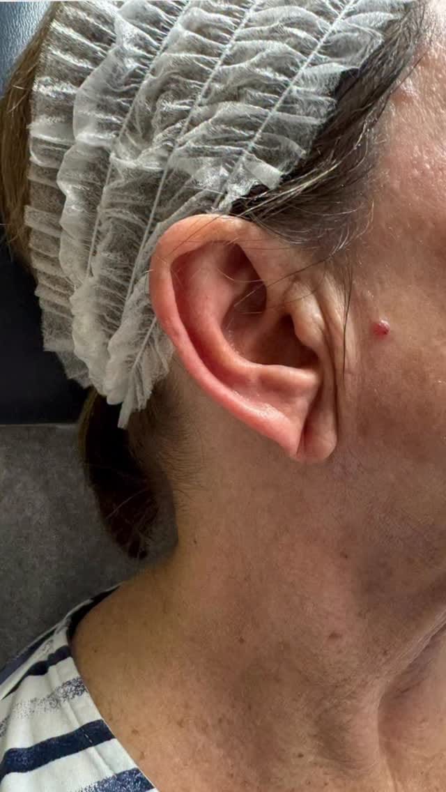 Post 6 by Dr. Blair Murphy-Rose, MD, FAAD on Instagram (video)