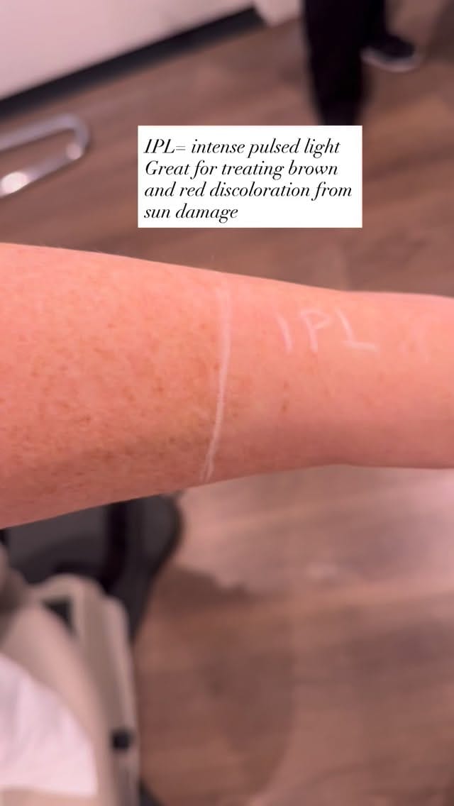 Post 5 by Dr. Blair Murphy-Rose, MD, FAAD on Instagram (video)