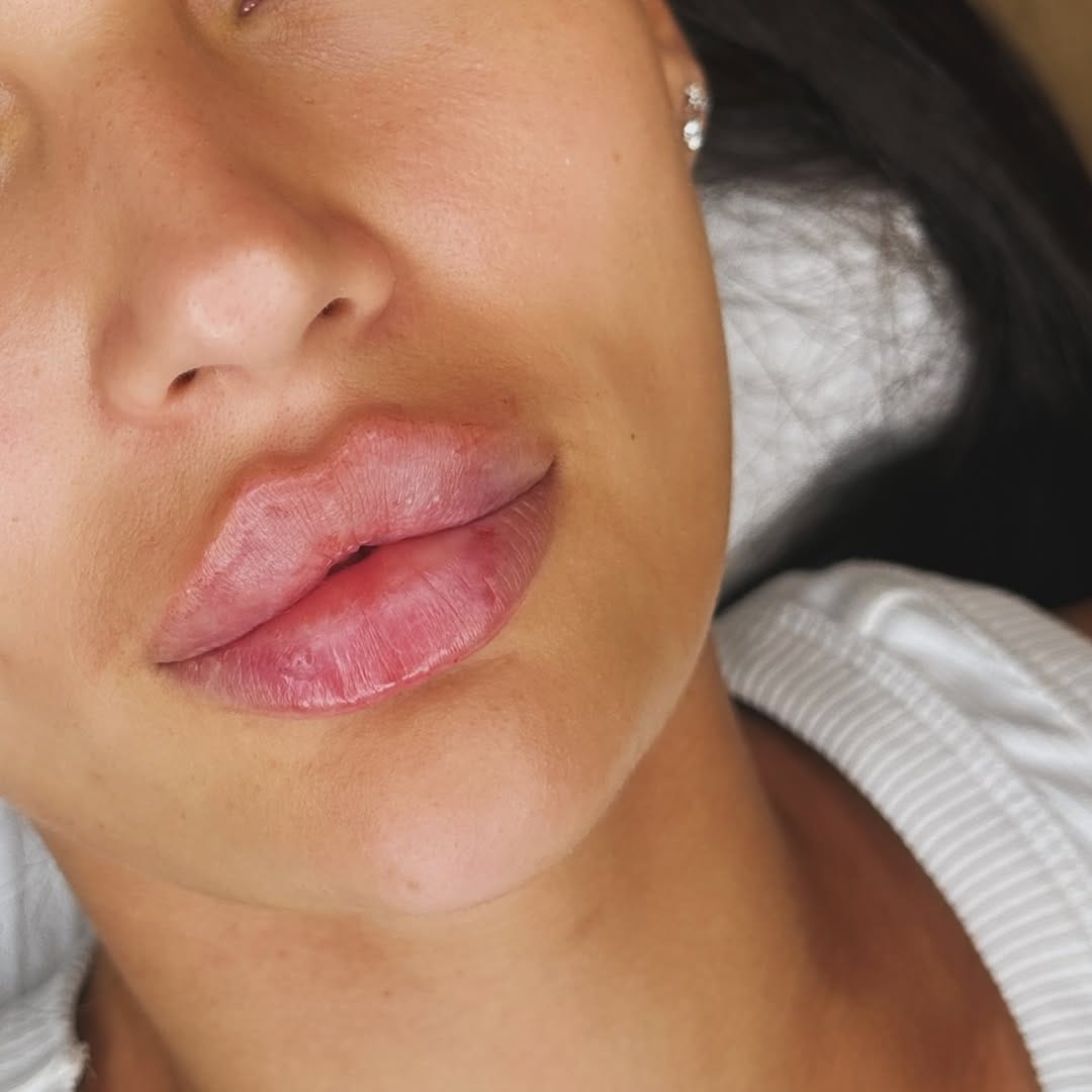 Post 9 by Sarah Attard -Beauty Aesthetic on Instagram (image)