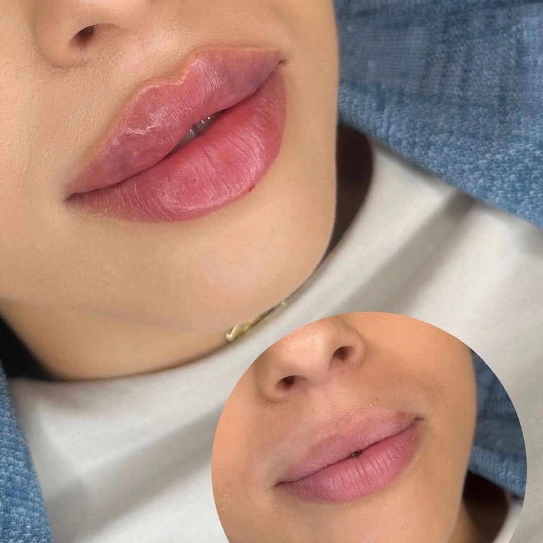 Post 3 by Sarah Attard -Beauty Aesthetic on Instagram (image)