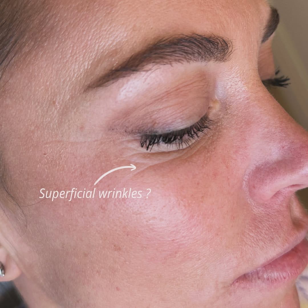 Post 2 by Sarah Attard -Beauty Aesthetic on Instagram (image)