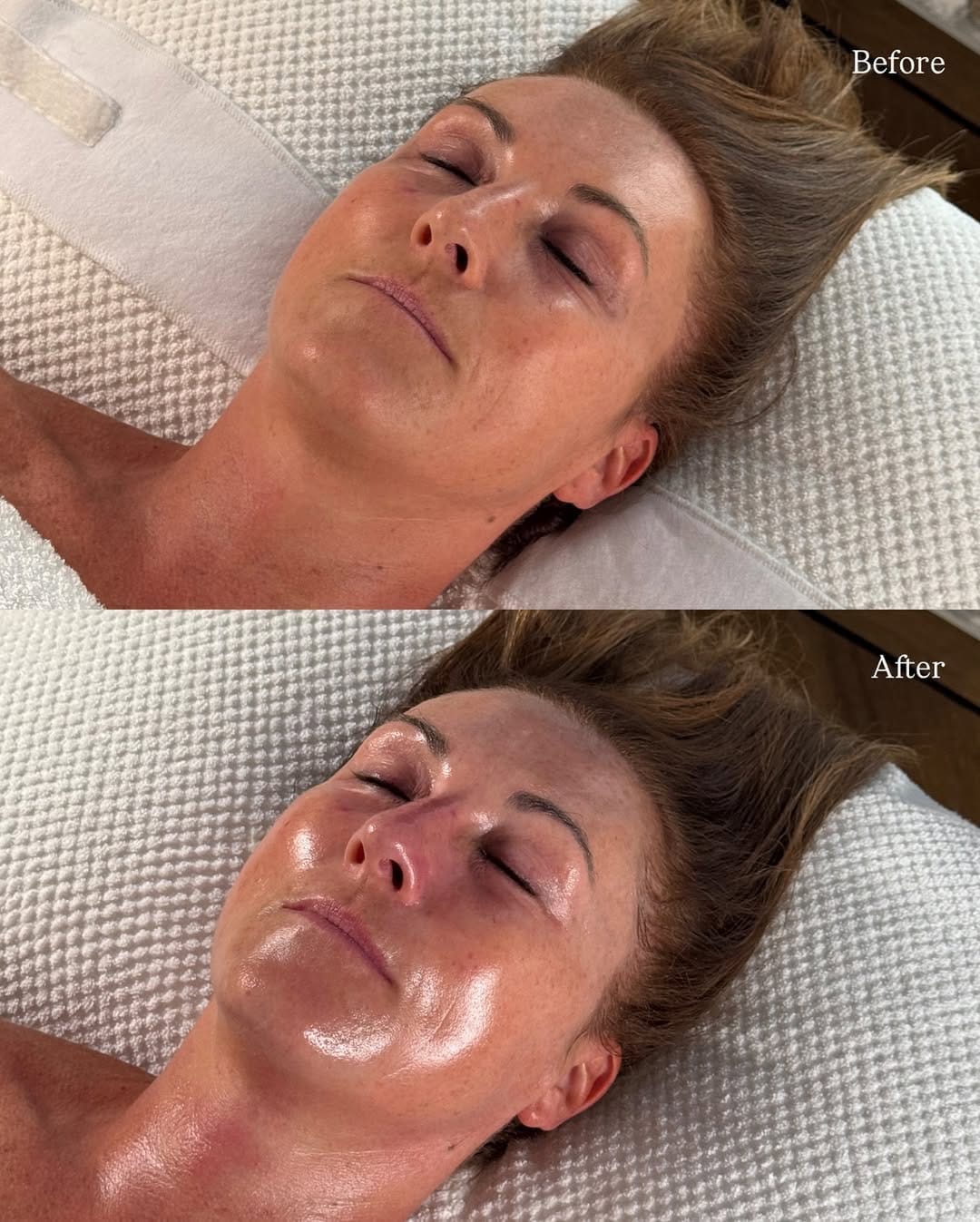 Post 6 by iSCLINICAL UK on Instagram (image)