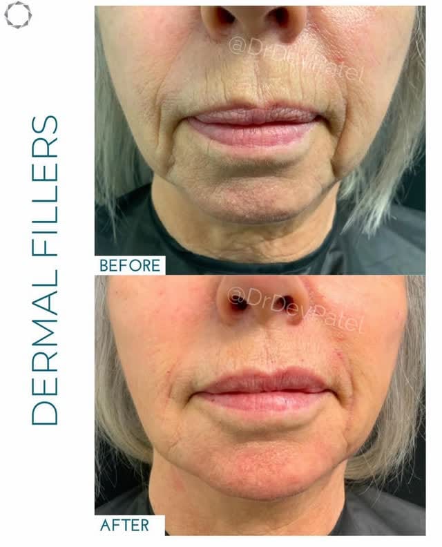 Post 1 by Perfect Skin Solutions Clinic on Instagram (video)