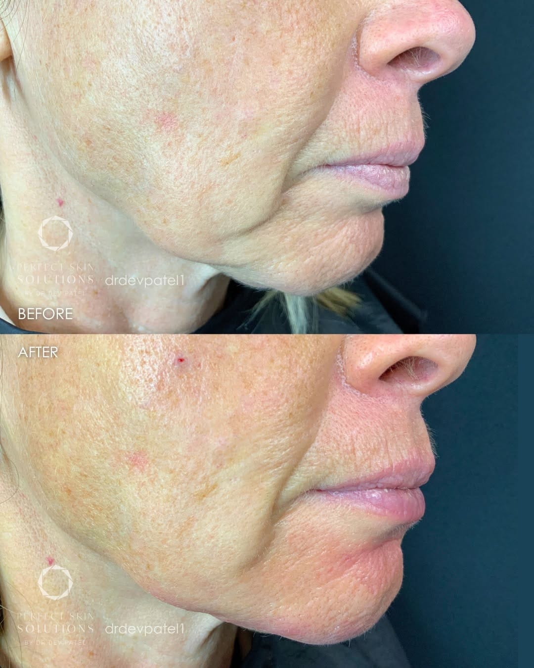 Post 6 by Perfect Skin Solutions Clinic on Instagram (image)