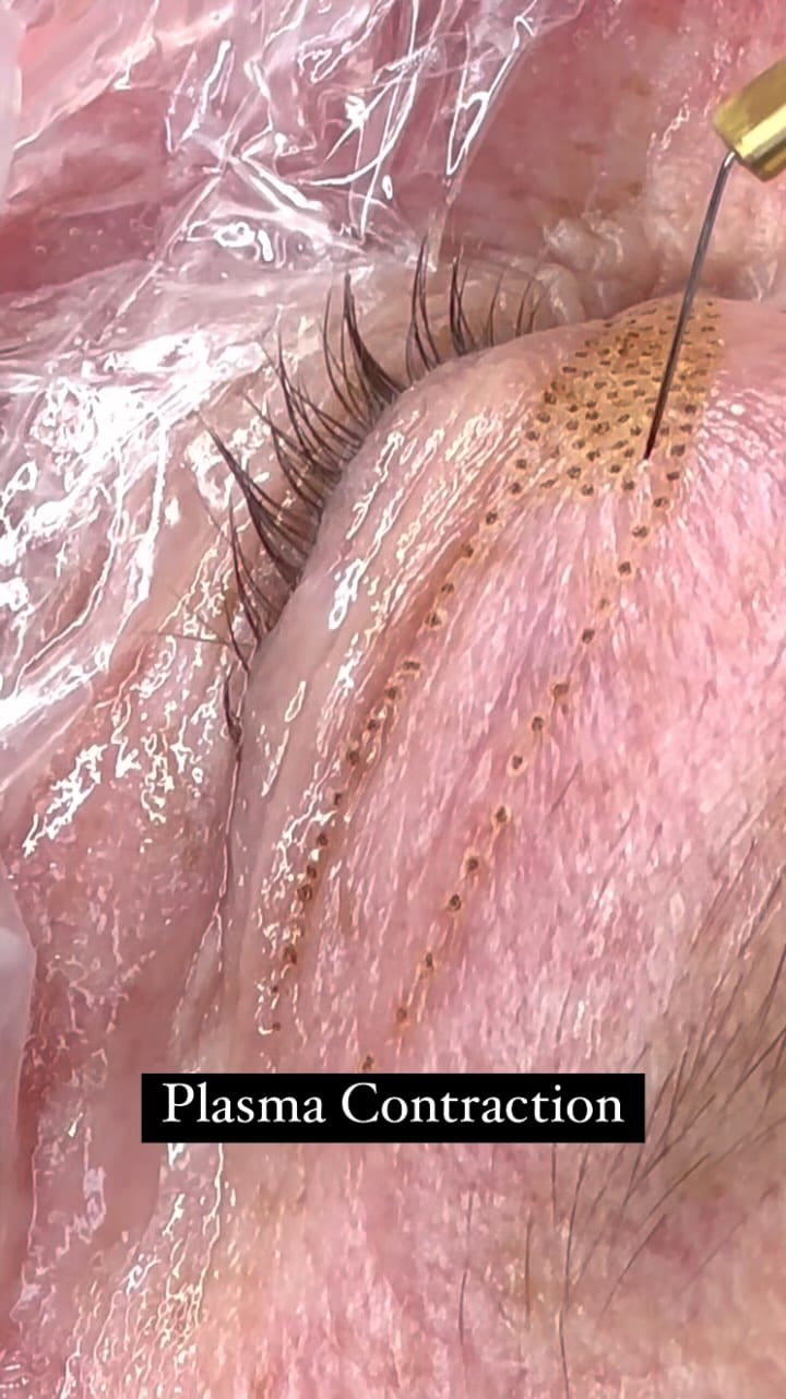 Post 8 by Christine | Skincare Expert | Integrative Skincare | FaceYoga on Instagram (video)