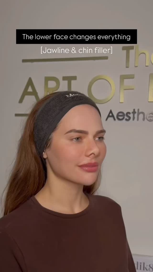 Post 3 by THE ART OF BEAUTY | AESTHETICS | LIP FILLERS | BOTOX on Instagram (video)