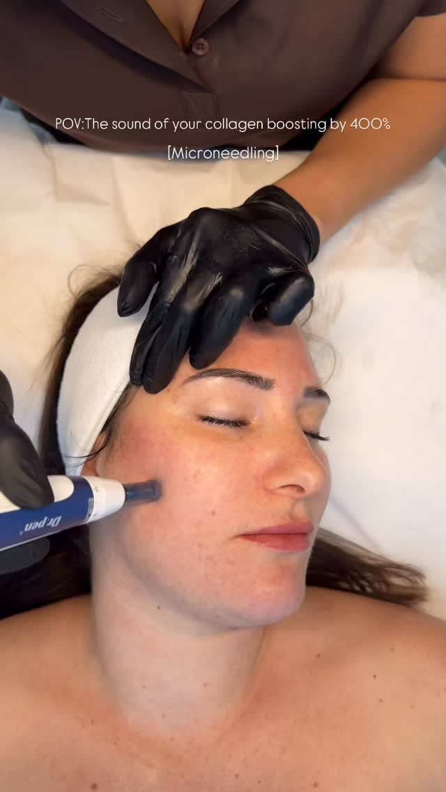 Post 7 by THE ART OF BEAUTY | AESTHETICS | LIP FILLERS | BOTOX on Instagram (video)