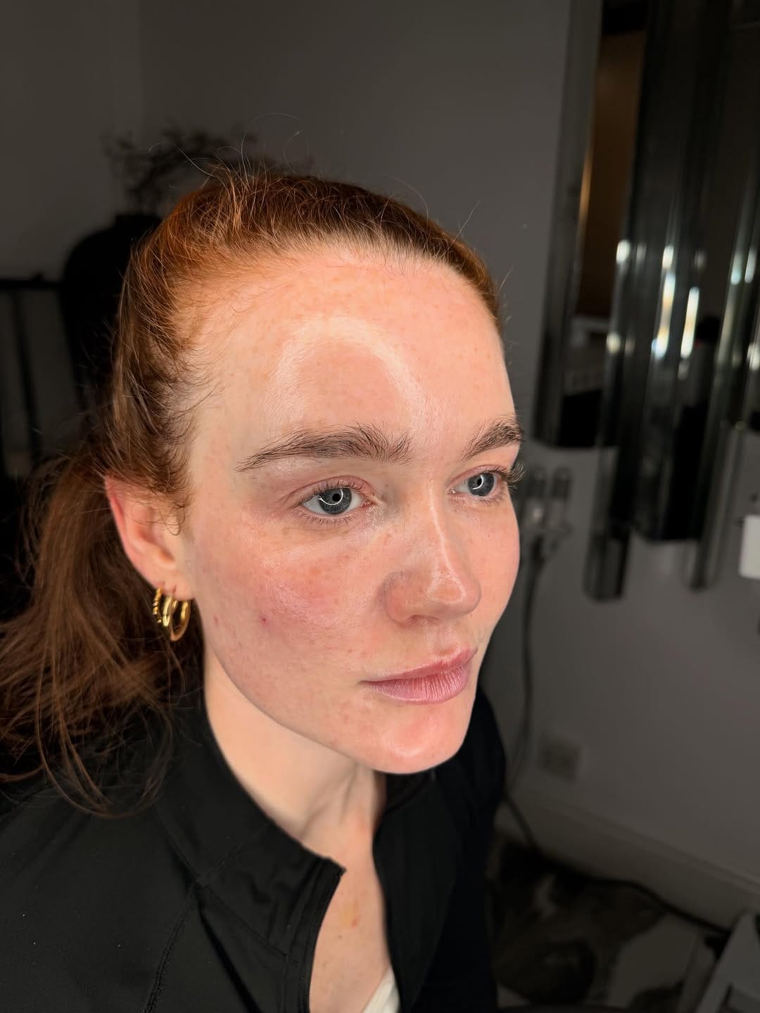 Post 9 by Skin Quartz Laser & Skin Clinic Manchester ™️ on Instagram (carousel)