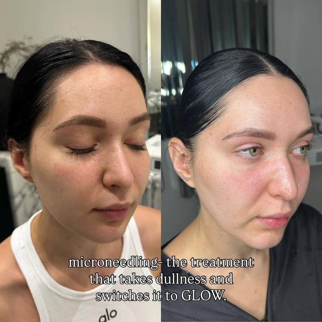 Post 6 by Skin Quartz Laser & Skin Clinic Manchester ™️ on Instagram (image)