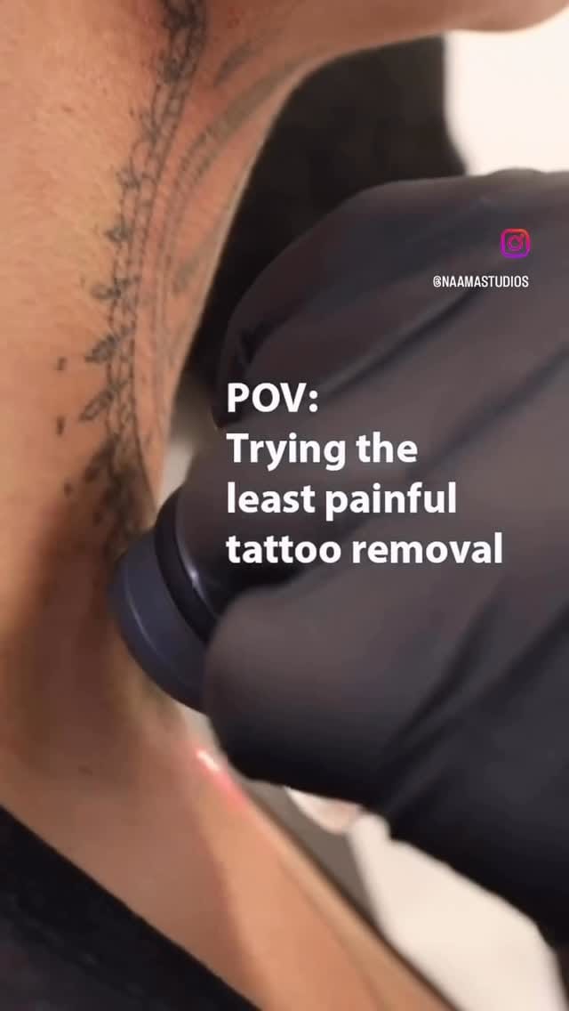 Post 5 by NAAMA Studios Laser Tattoo Removal on Instagram (video)