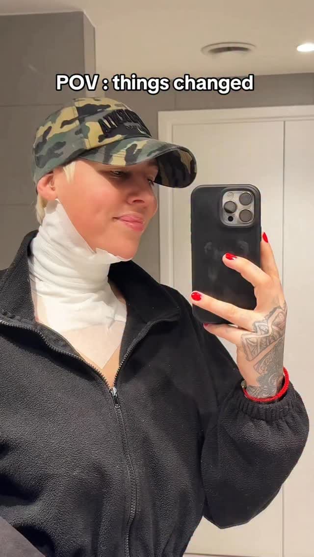 Post 2 by NAAMA Studios Laser Tattoo Removal on Instagram (video)
