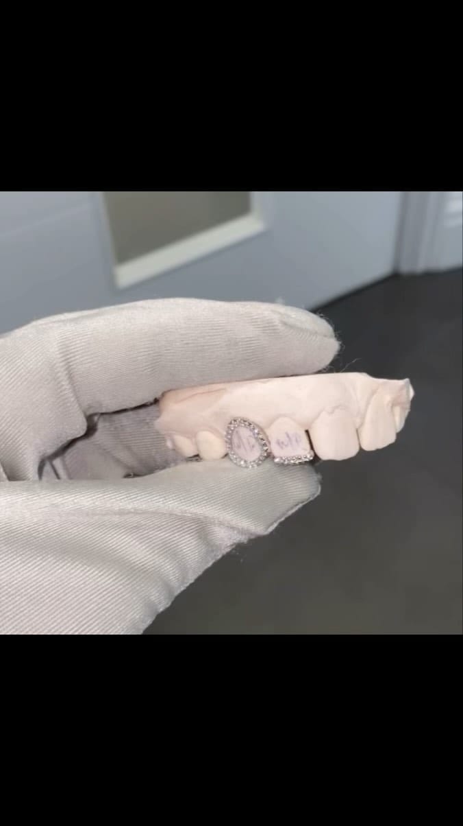 Post 6 by Grillz By The Tooth Fairy on Instagram (video)