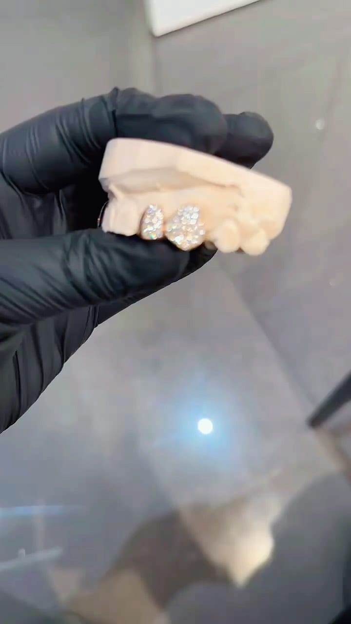 Post 2 by Grillz By The Tooth Fairy on Instagram (video)